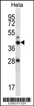 RAD23A Antibody (N-term)