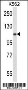 UBA1 Antibody (N-term)