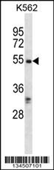 RIPK3 Antibody (C-term)