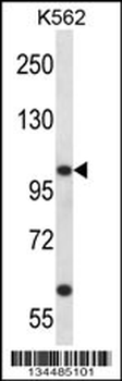 KCNC3 Antibody (C-term)