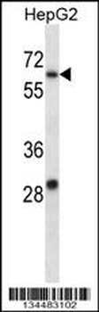 KCNC1 Antibody (C-term)