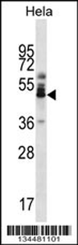 ZNF174 Antibody (Center)