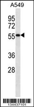 SEMG1 Antibody (N-term)