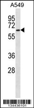 PRPF31 Antibody (C-term)