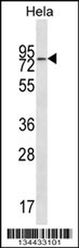WASF2 Antibody (Center)