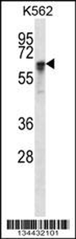 NXF1 Antibody (N-term)