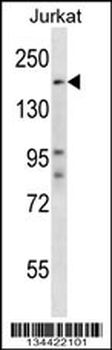 SUPT5H Antibody (Center)