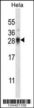 SNRPN Antibody (N-term)