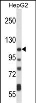 ATP2B4 Antibody (C-term)