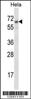 STS Antibody (C-term)