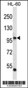 POLI Antibody (C-term)