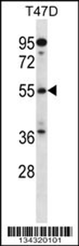 ARFGAP3 Antibody (C-term)