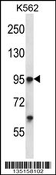 Mouse Tie1 Antibody (Center)