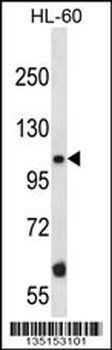 Mouse Taok2 Antibody (Center)