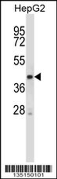 Mouse Stk25 Antibody (C-term)