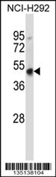 Mouse Hoxd3 Antibody (C-term)