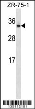 OTUB2 Antibody (N-term)