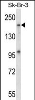 Mouse Map4k4 Antibody (Center)