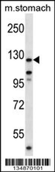 Mouse Ptk2 Antibody (Center)