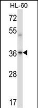 Mouse Prkaca/Prkacb Antibody (C-term)