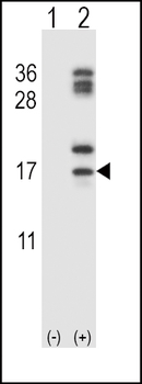 CLC Antibody (C-term)