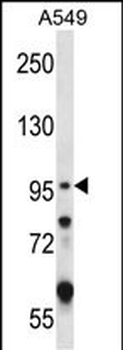 GRIK2 Antibody (C-term)