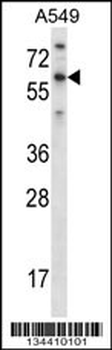 TBX21 Antibody (N-term)