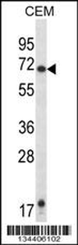 HRH1 Antibody (Center)