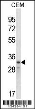 CCND2 Antibody (N-term)