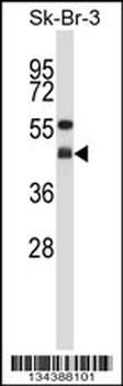 GNAI2 Antibody (N-term)