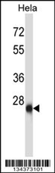 ZIC4 Antibody (N-term)