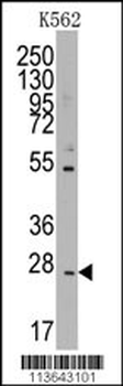 CD8B Antibody (N-term)