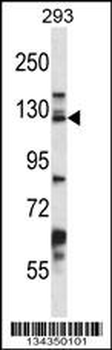DSG2 Antibody (C-term)