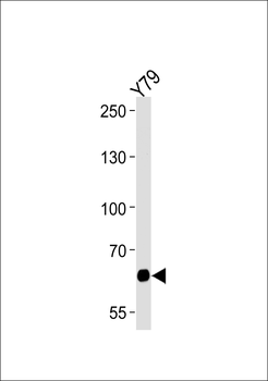 PPEF2 Antibody (Center)