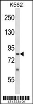 SENP5 Antibody (C-term)