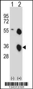 KLK8 Antibody (N-term)