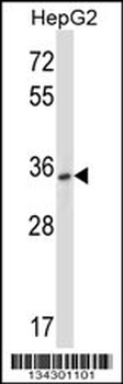 P2RY10 Antibody (Center)