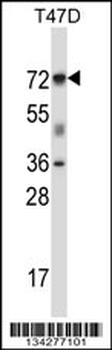 FOXK2 Antibody (N-term)