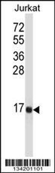 TAC3 Antibody (Center)