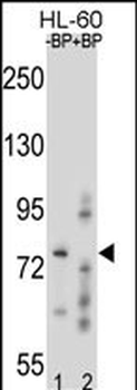 RNF40 Antibody (C-term)