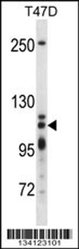 XRN2 Antibody (N-term)