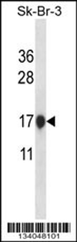 CSTB Antibody (Center)