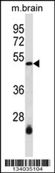 SMARCB1 Antibody (N-term)