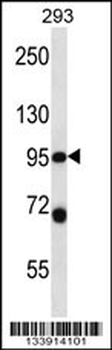 PSMD2 Antibody (N-term)