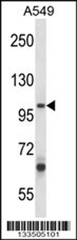 ZC3H12B Antibody (C-term)