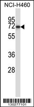 FZD9 Antibody (N-term)