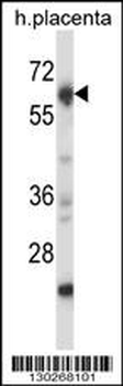 Mouse Nrbp2 Antibody (C-term)