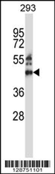 ZNF660 Antibody (C-term)