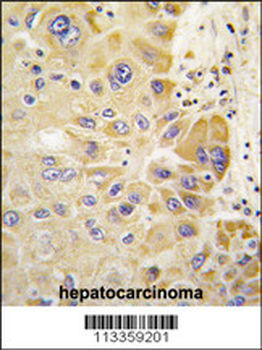 ALDH2 Antibody (Center)