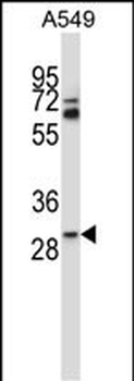 TATDN1 Antibody (Center)